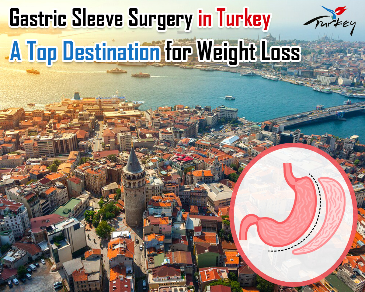 Gastric sleeve surgery turkey istanbul Gastric Sleeve Surgery in Turkey: A Top Destination for Life-Changing Weight Loss